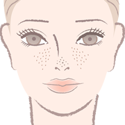 雀卵斑(そばかす)